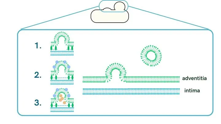 Figure 2 Image of Blebbing
