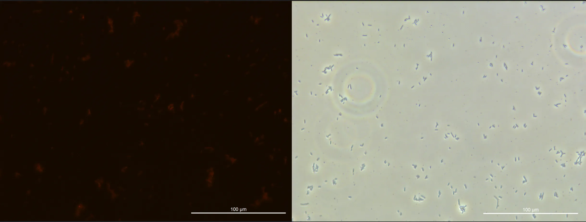 Figure 5. Microscopic observation results of E. coli cultured for
48h