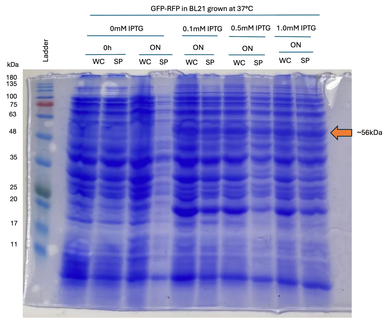 Proteina Rfp McGill - iGEM 2025