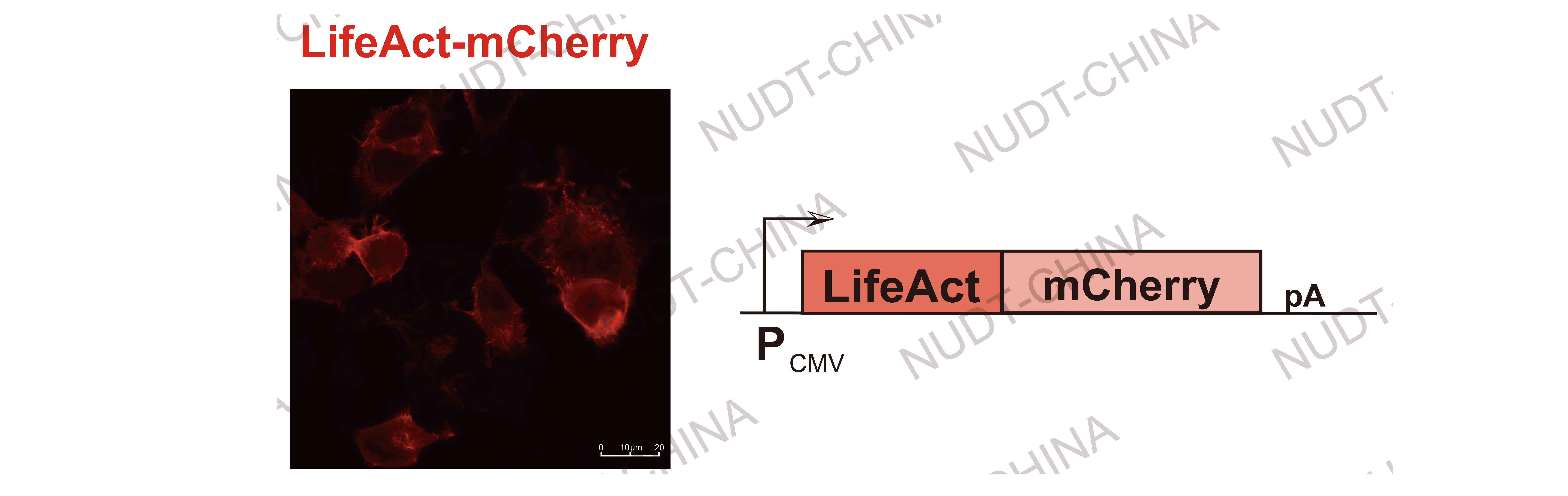 Confocal micrographs of cytoskeletal localization using LifeAct