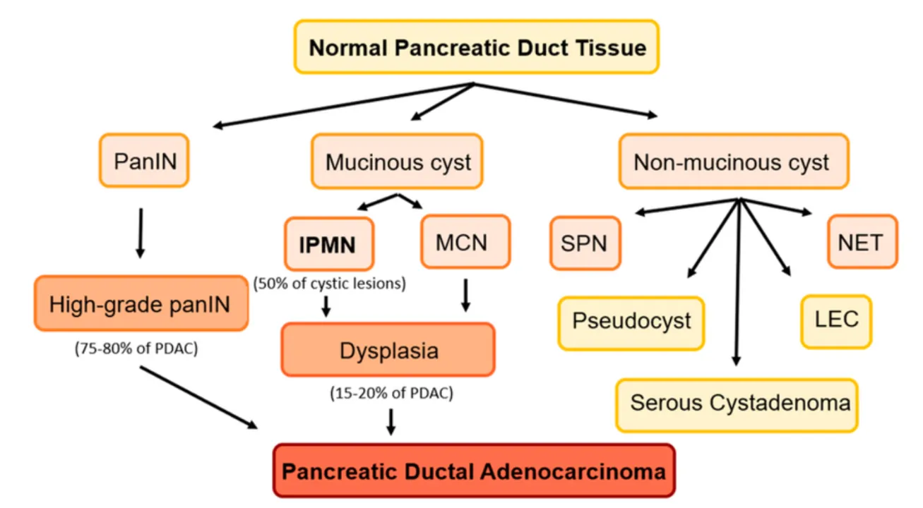 Precancerous lesions of the pancreas