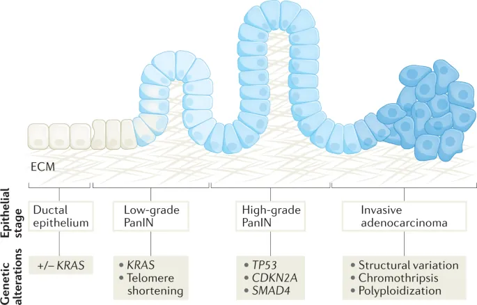 PanIN progression stages